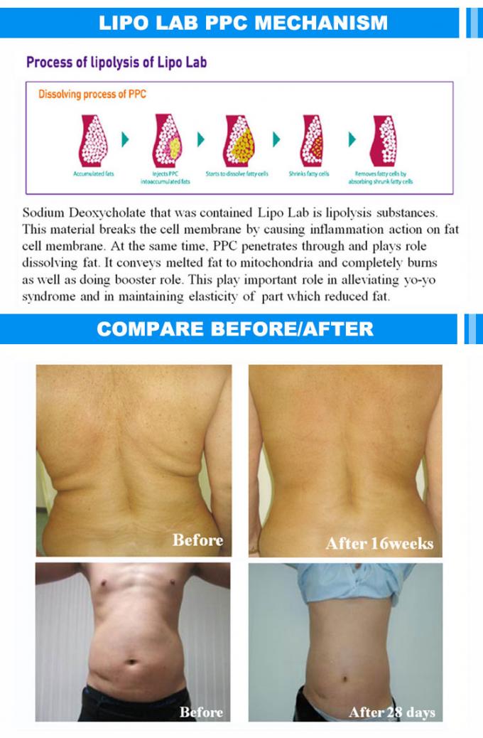 liquid lipo spray results