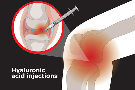Non-Crosslinked Hyaluronic Acid To Treat Knee 1ml, 1.5ml, 2ml Knee Joint Injection Ha Filler Sodium