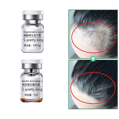 Hair Growth Serum Sets Kits Anti-Hair Loss Hair Treatment Stimulating Treatment Hair Care Essence