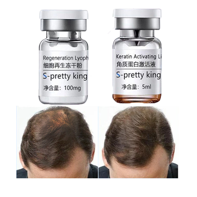 Hair Growth Serum Sets Kits Anti-Hair Loss Hair Treatment Stimulating Treatment Hair Care Essence