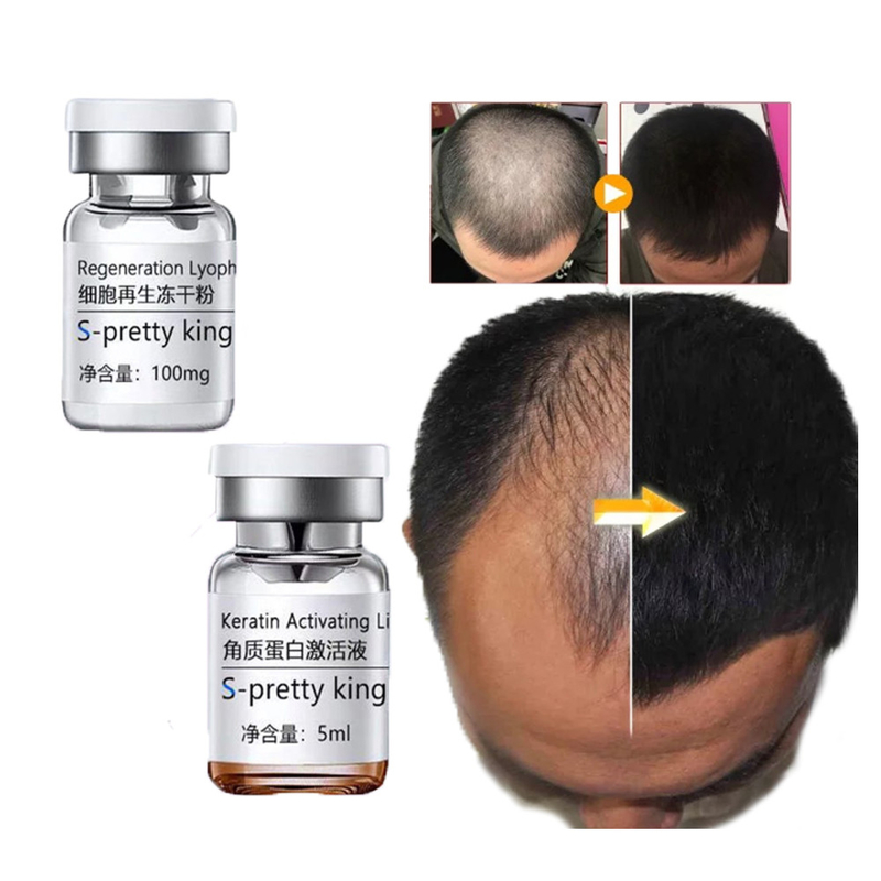 Hair Growth Serum Sets Kits Anti-Hair Loss Hair Treatment Stimulating Treatment Hair Care Essence